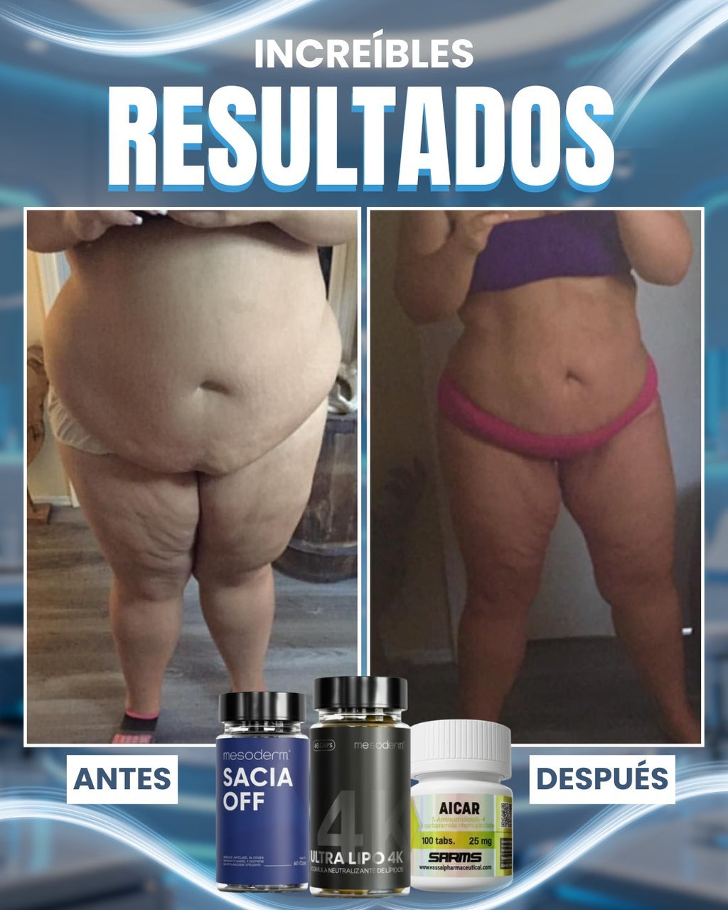 Tratamiento 30 Días Sacia Off & Ultra Lipo 4k